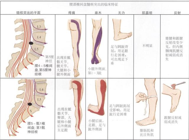 骨科医生推荐的睡姿，优化睡眠质量的有效方法