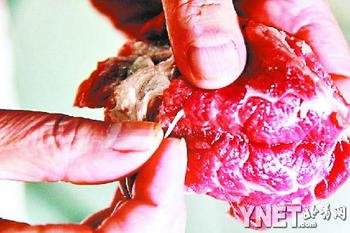 美国男子因食用未煮熟猪肉引发虫卵感染，食品安全警钟敲响