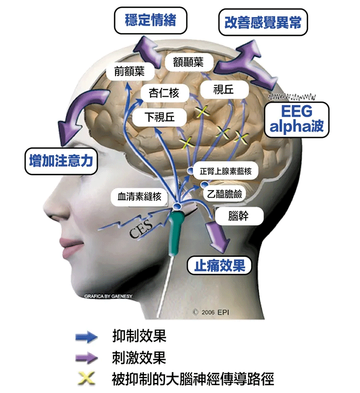 脑机接口技术，有望缩短入睡时间达25%的革命性进展